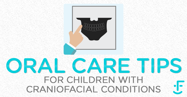 oral care for a child with a craniofacial condition feature image