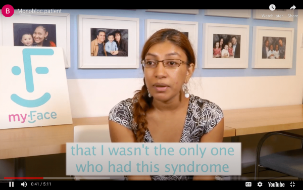 Picture of young woman with long light brown/blondish hair, wearing glasses, dangling earrings and a black and white decorative shirt. Text in image says that I wasn't the only one who had this syndrome. Screenshot of YouTube video about CIVA